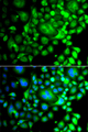 SNX3 Antibody - Immunofluorescence analysis of A549 cells.