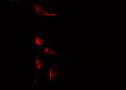 SNX4 Antibody - Staining HuvEc cells by IF/ICC. The samples were fixed with PFA and permeabilized in 0.1% Triton X-100, then blocked in 10% serum for 45 min at 25°C. The primary antibody was diluted at 1:200 and incubated with the sample for 1 hour at 37°C. An Alexa Fluor 594 conjugated goat anti-rabbit IgG (H+L) antibody, diluted at 1/600, was used as secondary antibody.