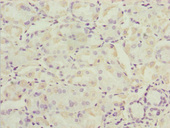 SNX7 Antibody - Immunohistochemistry of paraffin-embedded human small intestine tissue at dilution 1:100