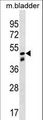 SNX8 Antibody - SNX8 Antibody western blot of mouse bladder tissue lysates (35 ug/lane). The SNX8 antibody detected the SNX8 protein (arrow).
