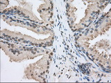 SNX9 / WISP Antibody - IHC of paraffin-embedded Human prostate tissue using anti-SNX9 mouse monoclonal antibody. (Dilution 1:50).