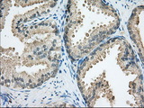 SNX9 / WISP Antibody - IHC of paraffin-embedded Human prostate tissue using anti-SNX9 mouse monoclonal antibody. (Dilution 1:50).