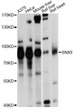 SNX9 / WISP Antibody - Western blot analysis of extracts of various cell lines, using SNX9 antibody at 1:1000 dilution. The secondary antibody used was an HRP Goat Anti-Rabbit IgG (H+L) at 1:10000 dilution. Lysates were loaded 25ug per lane and 3% nonfat dry milk in TBST was used for blocking. An ECL Kit was used for detection and the exposure time was 1s.