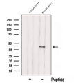 SOAT2 Antibody - Western blot analysis of extracts of mouse liver tissue using ACAT2 antibody. The lane on the left was treated with blocking peptide.