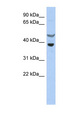 SOCS7 / SOCS-7 Antibody - SOCS7 antibody Western blot of OVCAR-3 cell lysate. This image was taken for the unconjugated form of this product. Other forms have not been tested.