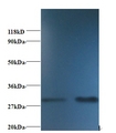 SOD1 / Cu-Zn SOD Antibody - Western blot of Superoxide dismutase [Cu-Zn] antibody at 2 ug/ml. Lane 1: EC109 whole cell lysate. Lane 2: 293T whole cell lysate. Secondary: Goat polyclonal to Rabbit IgG at 1:15000 dilution. Predicted band size: 17 kDa. Observed band size: 32 kDa.  This image was taken for the unconjugated form of this product. Other forms have not been tested.