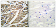 Sodium Channel Antibody - Immunohistochemistry analysis of paraffin-embedded human heart tissue, using Sodium Channel-pan Antibody. The picture on the right is blocked with the synthesized peptide.