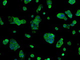 SORD / Sorbitol Dehydrogenase Antibody - Immunofluorescent staining of HepG2 cells using anti-SORD mouse monoclonal antibody.