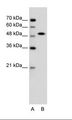 SOX11 Antibody - A: Marker, B: Jurkat Cell Lysate.  This image was taken for the unconjugated form of this product. Other forms have not been tested.