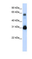 SOX15 Antibody - SOX15 antibody Western blot of Transfected 293T cell lysate. This image was taken for the unconjugated form of this product. Other forms have not been tested.