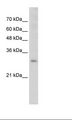 SOX15 Antibody - Transfected 293T Cell Lysate.  This image was taken for the unconjugated form of this product. Other forms have not been tested.