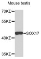 SOX17 Antibody - Western blot analysis of extracts of mouse testis, using SOX17 antibody. The secondary antibody used was an HRP Goat Anti-Rabbit IgG (H+L) at 1:10000 dilution. Lysates were loaded 25ug per lane and 3% nonfat dry milk in TBST was used for blocking.