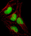 SOX18 Antibody - Fluorescent confocal image of HeLa cell stained with SOX18 Antibody. HeLa cells were fixed with 4% PFA (20 min), permeabilized with Triton X-100 (0.1%, 10 min), then incubated with SOX18 primary antibody (1:25, 1 h at 37°C). For secondary antibody, Alexa Fluor 488 conjugated donkey anti-rabbit antibody (green) was used (1:400, 50 min at 37°C). Cytoplasmic actin was counterstained with Alexa Fluor 555 (red) conjugated Phalloidin (7units/ml, 1 h at 37°C). Nuclei were counterstained with DAPI (blue) (10 ug/ml, 10 min). SOX18 immunoreactivity is localized to Nucleus significantly.