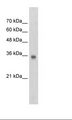 SOX2 Antibody - Jurkat Cell Lysate.  This image was taken for the unconjugated form of this product. Other forms have not been tested.