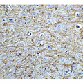 SOX2 Antibody - Immunohistochemistry of SOX2 in mouse brain tissue with SOX2 Antibodyat 5 µg/mL.