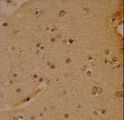 SOX4 Antibody - Formalin-fixed and paraffin-embedded human brain reacted with SOX4 Antibody , which was peroxidase-conjugated to the secondary antibody, followed by DAB staining. This data demonstrates the use of this antibody for immunohistochemistry; clinical relevance has not been evaluated.