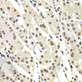 SOX5 Antibody - Immunohistochemistry of paraffin-embedded human stomach tissue.