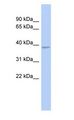 SOX7 Antibody - SOX7 antibody Western Blot of Fetal Stomach cell lysate.  This image was taken for the unconjugated form of this product. Other forms have not been tested.