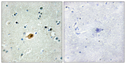 Sox8+9+17+18 Antibody - Immunohistochemistry analysis of paraffin-embedded human brain tissue, using SOX8/9/17/18 Antibody. The picture on the right is blocked with the synthesized peptide.