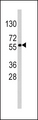 SOX9 Antibody - Western blot of anti-SOX9 Antibody (RB13405) in HepG2 cell line lysates (35 ug/lane). SOX9(arrow) was detected using the purified antibody.
