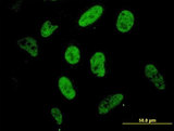 SP1 Antibody - Immunofluorescence of monoclonal antibody to SP1 on HeLa cell. [antibody concentration 10 ug/ml]