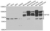 SP100 Antibody - Western blot analysis of extracts of various cell lines.