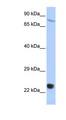 SP110 Antibody - SP110 antibody Western blot of HepG2 cell lysate. This image was taken for the unconjugated form of this product. Other forms have not been tested.
