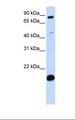 SP110 Antibody - MCF7 cell lysate. Antibody concentration: 1.0 ug/ml. Gel concentration: 12%.  This image was taken for the unconjugated form of this product. Other forms have not been tested.