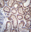 SP140 Antibody - SP140 Antibody immunohistochemistry of formalin-fixed and paraffin-embedded human kidney tissue followed by peroxidase-conjugated secondary antibody and DAB staining.