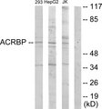 SP32 / ACRBP Antibody - Western blot analysis of lysates from HepG2, Jurkat, and 293 cells, using ACRBP Antibody. The lane on the right is blocked with the synthesized peptide.