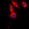 SP32 / ACRBP Antibody - Immunofluorescent analysis of ACRBP staining in HeLa cells. Formalin-fixed cells were permeabilized with 0.1% Triton X-100 in TBS for 5-10 minutes and blocked with 3% BSA-PBS for 30 minutes at room temperature. Cells were probed with the primary antibody in 3% BSA-PBS and incubated overnight at 4 C in a humidified chamber. Cells were washed with PBST and incubated with a DyLight 594-conjugated secondary antibody (red) in PBS at room temperature in the dark. DAPI was used to stain the cell nuclei (blue).
