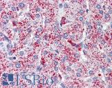 SP4 Antibody - Anti-SP4 antibody IHC of human liver. Immunohistochemistry of formalin-fixed, paraffin-embedded tissue after heat-induced antigen retrieval. Antibody concentration 5 ug/ml.  This image was taken for the unconjugated form of this product. Other forms have not been tested.