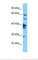 SPAG16 Antibody - Western blot of Human HepG2. SPAG16 antibody dilution 1.0 ug/ml.  This image was taken for the unconjugated form of this product. Other forms have not been tested.