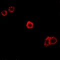 SPAM1 / PH20 Antibody - Immunofluorescent analysis of SPAM1 staining in HeLa cells. Formalin-fixed cells were permeabilized with 0.1% Triton X-100 in TBS for 5-10 minutes and blocked with 3% BSA-PBS for 30 minutes at room temperature. Cells were probed with the primary antibody in 3% BSA-PBS and incubated overnight at 4 deg C in a humidified chamber. Cells were washed with PBST and incubated with a DyLight 594-conjugated secondary antibody (red) in PBS at room temperature in the dark.