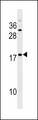 SPANXD Antibody - SPANXE Antibody western blot of HepG2 cell line lysates (35 ug/lane). The SPANXE antibody detected the SPANXE protein (arrow).