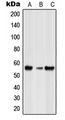 Spastic / GLRB Antibody - Western blot analysis of GLRB expression in HeLa (A); NIH3T3 (B); rat spleen (C) whole cell lysates.