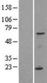 SPATA16 / NYD-SP12 Protein - Western validation with an anti-DDK antibody * L: Control HEK293 lysate R: Over-expression lysate