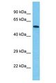 SPATA20 Antibody - SPATA20 antibody Western Blot of Colorectal Tumor. Antibody dilution: 1 ug/ml.  This image was taken for the unconjugated form of this product. Other forms have not been tested.