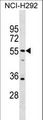 SPATA21 Antibody - SPATA21 Antibody western blot of NCI-H292 cell line lysates (35 ug/lane). The SPATA21 antibody detected the SPATA21 protein (arrow).