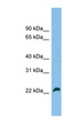 SPATA24 Antibody - SPATA24 antibody Western blot of Jurkat lysate. This image was taken for the unconjugated form of this product. Other forms have not been tested.