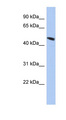 SPATA6L Antibody - C9orf68 antibody Western blot of HepG2 cell lysate. This image was taken for the unconjugated form of this product. Other forms have not been tested.