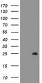 SPATC1L / C21orf56 Antibody - HEK293T cells were transfected with the pCMV6-ENTRY control (Left lane) or pCMV6-ENTRY C21orf56 (Right lane) cDNA for 48 hrs and lysed. Equivalent amounts of cell lysates (5 ug per lane) were separated by SDS-PAGE and immunoblotted with anti-C21orf56.
