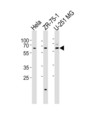 SPATS2 Antibody - Western blot of lysates from HeLa, ZR-75-1, U-251 MG cell line (from left to right) with SPATS2 Antibody. Antibody was diluted at 1:1000 at each lane. A goat anti-rabbit IgG H&L (HRP) at 1:5000 dilution was used as the secondary antibody. Lysates at 35 ug per lane.