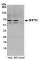SPATS2 Antibody - Detection of human SPATS2 by western blot. Samples: Whole cell lysate (10 µg) from HeLa, HEK293T, and Jurkat cells prepared using NETN lysis buffer. Antibody: Affinity purified rabbit anti-SPATS2 antibody used for WB at 0.1 µg/ml. Detection: Chemiluminescence with an exposure time of 3 minutes.