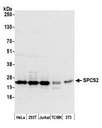 SPCS2 Antibody - Detection of human and mouse SPCS2 by western blot. Samples: Whole cell lysate (50 µg) from HeLa, HEK293T, Jurkat, mouse TCMK-1, and mouse NIH 3T3 cells prepared using NETN lysis buffer. Antibody: Affinity purified rabbit anti-SPCS2 antibody used for WB at 1:1000. Detection: Chemiluminescence with an exposure time of 30 seconds.