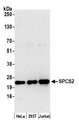 SPCS2 Antibody - Detection of human SPCS2 by western blot. Samples: Whole cell lysate (15 µg) from HeLa, HEK293T, and Jurkat cells prepared using NETN lysis buffer. Antibody: Affinity purified rabbit anti-SPCS2 antibody used for WB at 1:1000. Detection: Chemiluminescence with an exposure time of 30 seconds.