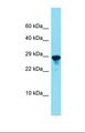 SPCS2 Antibody - Western blot of Rat Lung. Spcs2 antibody dilution 1.0 ug/ml.  This image was taken for the unconjugated form of this product. Other forms have not been tested.
