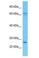SPDYE2L Antibody - SPDYE2B / SPDYE2L antibody Western Blot of HCT15. Antibody dilution: 1 ug/ml.  This image was taken for the unconjugated form of this product. Other forms have not been tested.