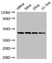 speB Antibody - Western Blot Positive WB detected in Recombinant protein All Lanes:speB antibody at 3.2µg/ml Secondary Goat polyclonal to rabbit IgG at 1/50000 dilution Predicted band size: 44 kDa Observed band size: 44 kDa