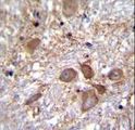 SPECC1 / CYTSB Antibody - SPECC1 Antibody immunohistochemistry of formalin-fixed and paraffin-embedded human brain tissue followed by peroxidase-conjugated secondary antibody and DAB staining.